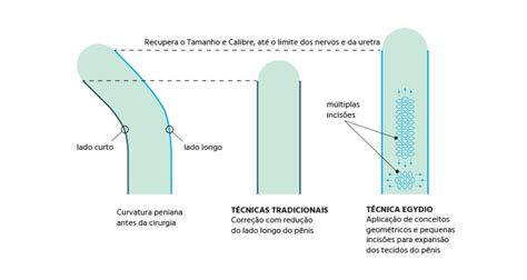 pau fino|8 Tipos de Pênis: Características e Variações